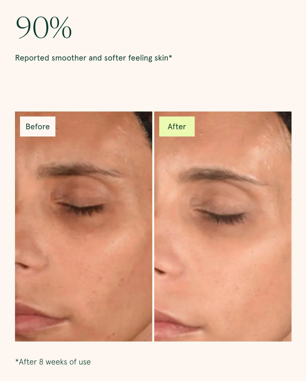 Toning Pads